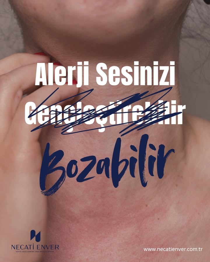Bahar geldi, alerji sezonu açıldı. Peki bu dönemin sesinizi ne kadar yakından ilgilendirdiğini biliyor musunuz?

Özellikle sesini profesyonel olarak kullananlar veya sahneye çıkanlar için alerji, sadece hapşırmaktan çok daha fazlası demek. Süreç aslında zincirleme bir reaksiyon gibi ilerliyor:

* Mukozal ödem ve geniz akıntısı ses tellerinin doğal titreşimini bozuyor.
* Akıntı hissiyle yaptığımız o sürekli boğaz temizleme hareketi, ses tellerine her seferinde küçük travmalar yaşatıyor.
* Üstüne bir de kulaktan dolma bilgilerle alınan alerji hapları (antihistaminikler) eklenince, ses tellerinde aşırı kuruluk ve seste kısıklık kaçınılmaz oluyor.

Şu Belirtilere Dikkat!
- Eğer son zamanlarda şunları yaşıyorsanız, sebebi alerji olabilir:
- Sabahları ses kısıklığı ile uyanmak
- Konuşurken seste çatallanma olması
- Performans veya yoğun konuşma sonrası sesin çok geç toparlanması
- Geçmeyen bir boğaz temizleme ihtiyacı

Peki Ne Yapmalı?
Sahne sizin, ama öncesinde sesinizi korumak için şu adımlara dikkat:

* Hekiminizle Görüşün: Alerji ilaçlarınızı mutlaka bir KBB hekimi kontrolünde seçin.
* Sprey Alternatifi: Doktorunuz onaylıyorsa, sesi daha az kuruttuğu için burun spreyleri antihistaminik haplara tercih edilebilir.
* Bol Su Tüketin: Ses tellerinin nemi için hidrasyon kritik. Günde en az 2-2.5 litre su tüketin.
* Ses Isınması: Sahne öncesi ses tellerini esnetmeyi asla ihmal etmeyin.
* Stroboskopik Kontrol: Alerji döneminde ses tellerinin durumunu net görmek için stroboskopi yaptırın.

Konuyla ilgili videoya ulaşmak isterseniz yorumlara ALERJİ yazın, videoyu DM üzerinden sizinle paylaşalım! 👇